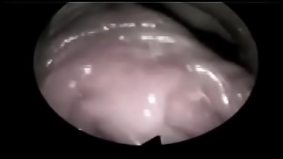Movie inward labia